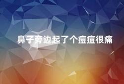 鼻子旁边起了个痘痘很痛（鼻旁痘痘的成因及治疗方法）